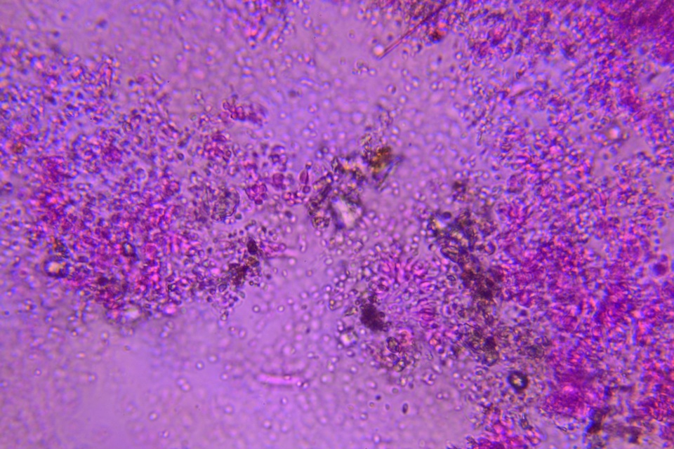 Beauveria brongniartii image