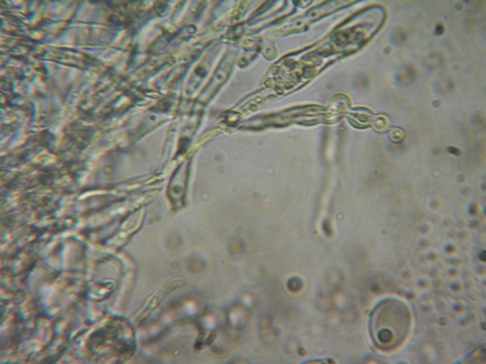 Aleurodiscus grantii image