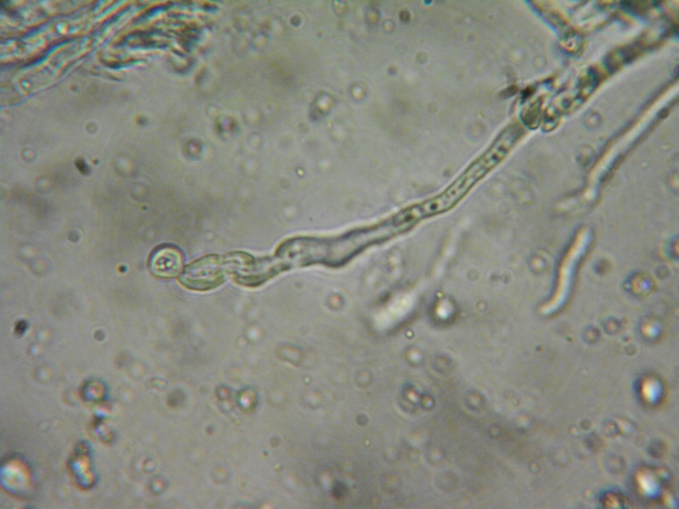 Aleurodiscus grantii image