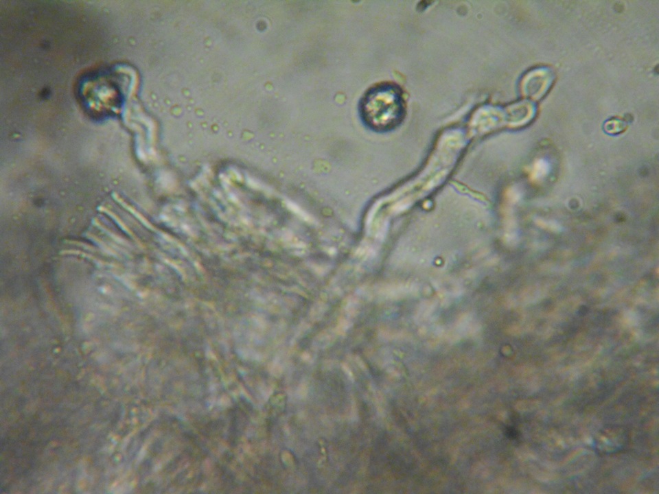 Aleurodiscus grantii image