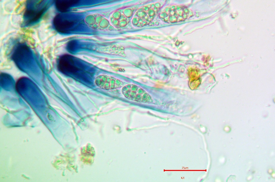 Leptogium biatorinum image