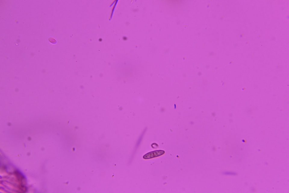 Dactylospora stygia image