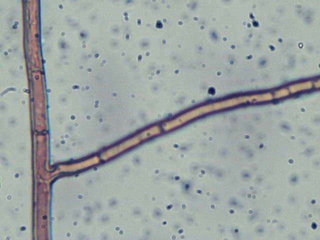Coltriciella dependens image