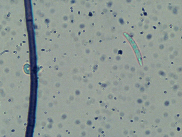 Menispora cobaltina image