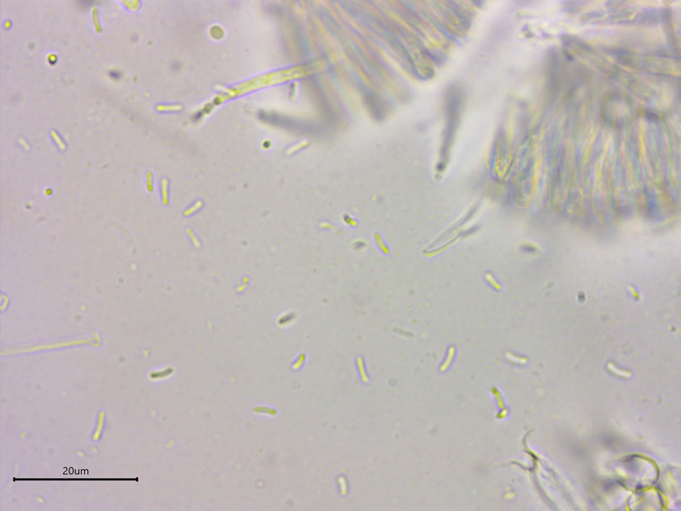 Orbilia leucostigma image