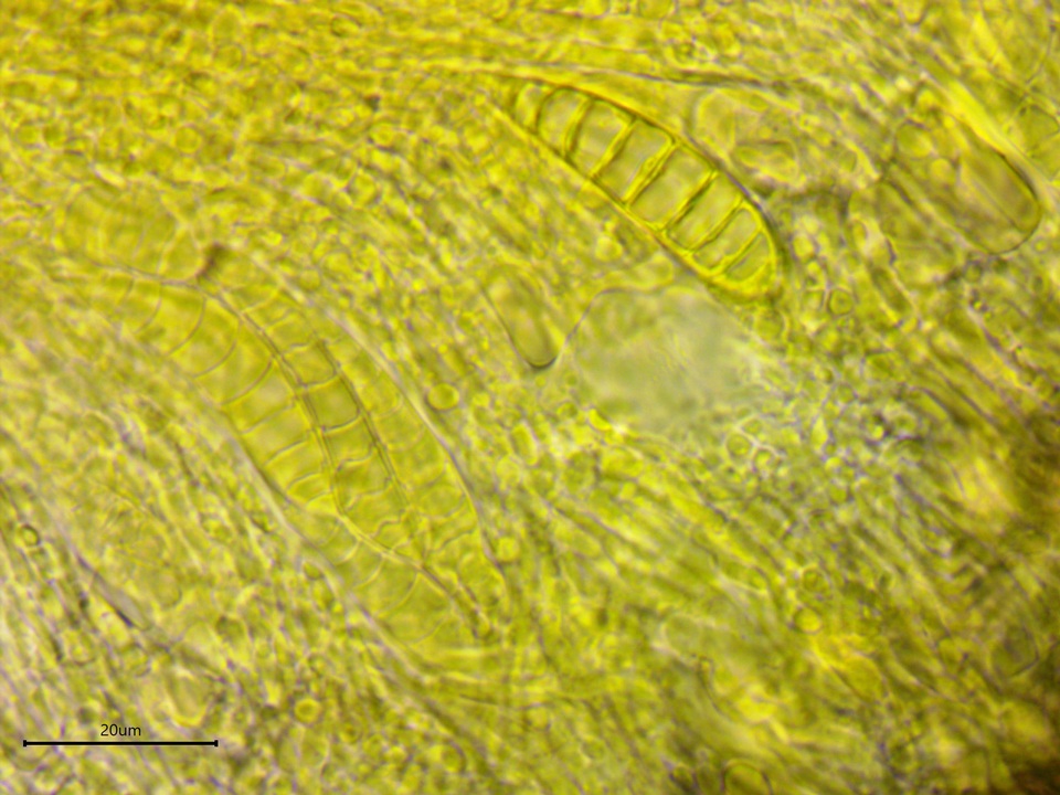 Patellaria atrata image
