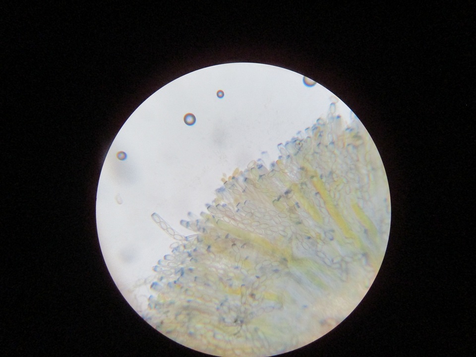 Peziza echinospora image