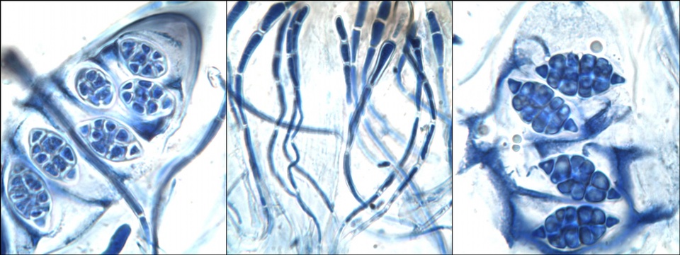 Leptogium cochleatum image