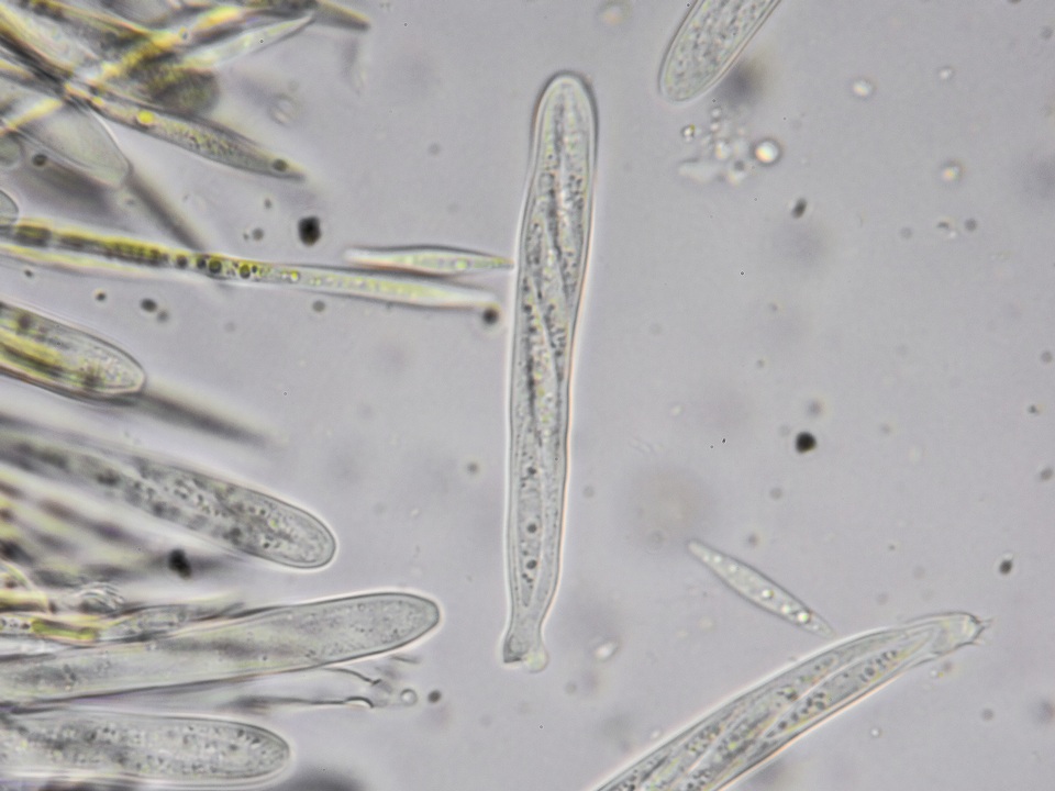 Lachnellula ellisiana image