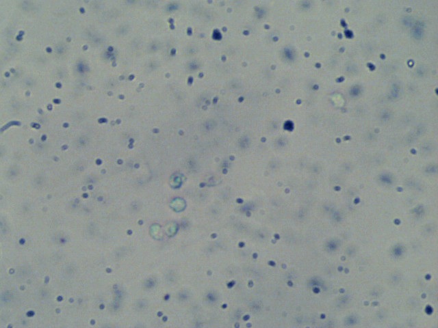 Trechispora image