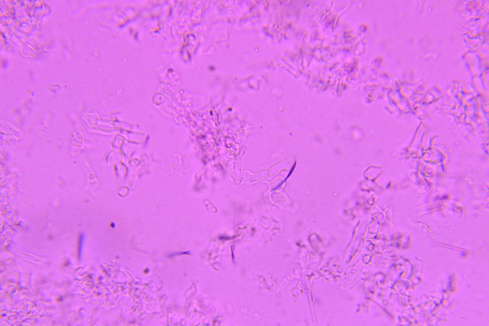 Athelia rolfsii image