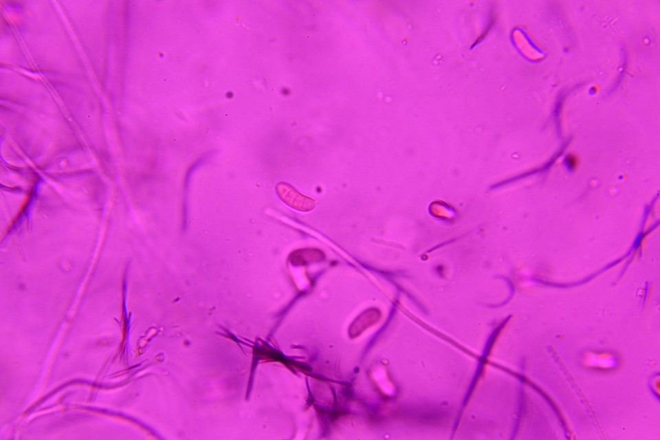 Dacrymyces minor image