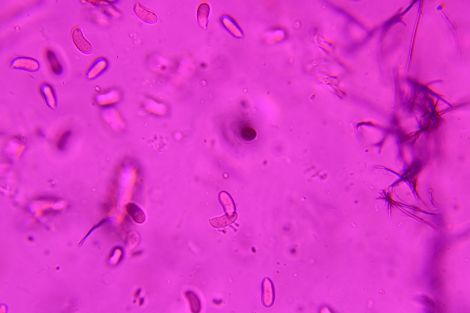 Dacrymyces minor image