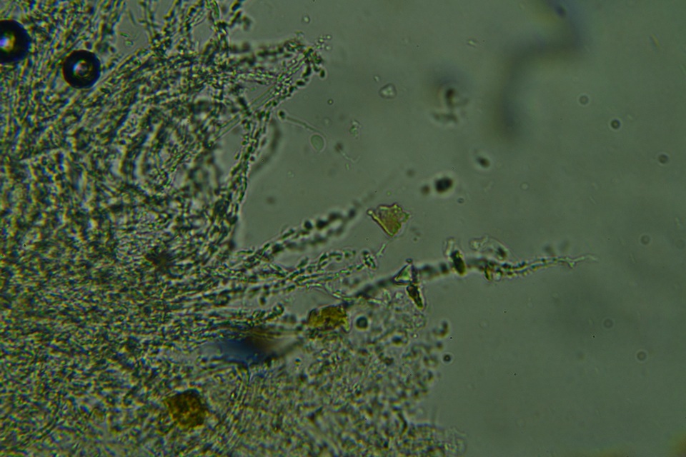 Flagelloscypha minutissima image