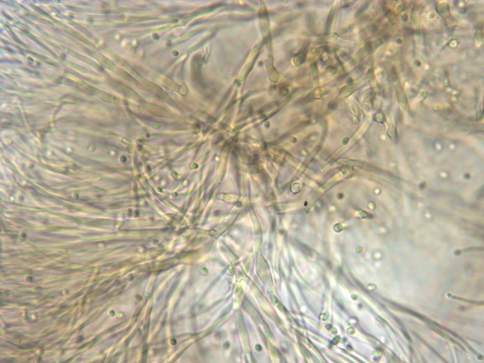 Ascocoryne trichophora image