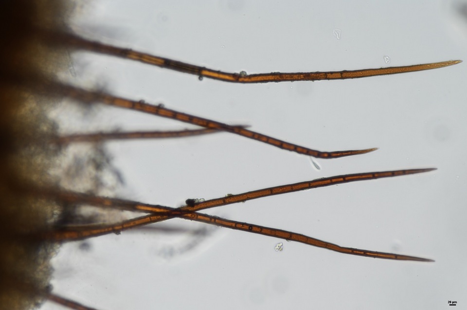 Scutellinia pennsylvanica image