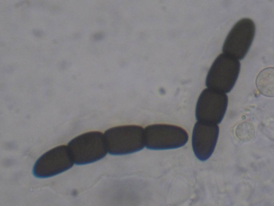 Sporormiella australis image