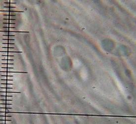 Lecidella enteroleucella image
