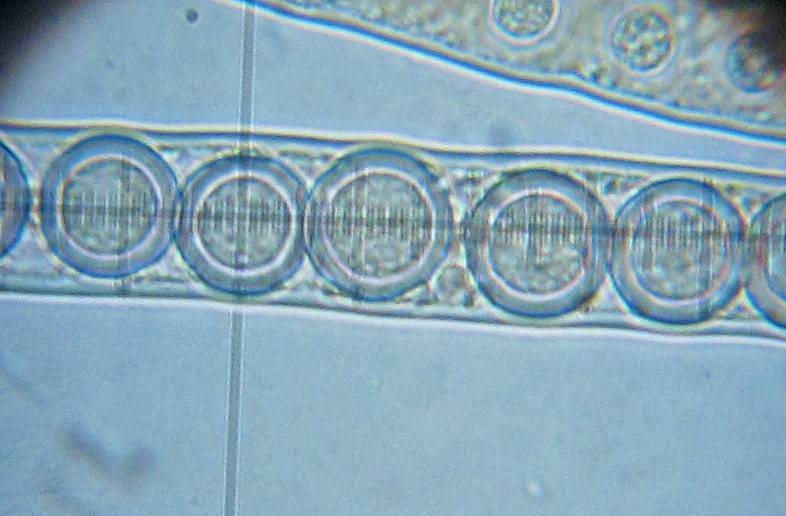 Pseudoplectania melaena image