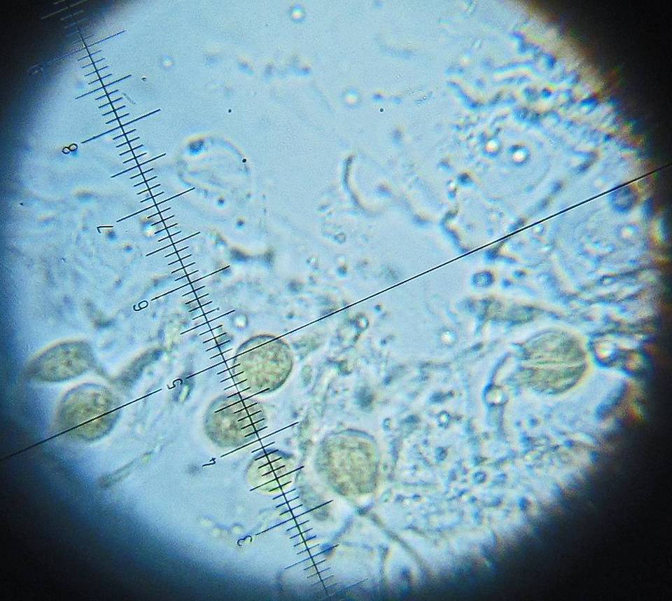 Craterocolla cerasi image