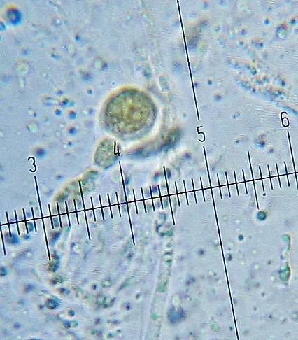 Craterocolla cerasi image