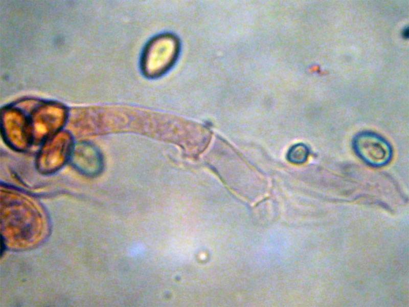 Meottomyces dissimulans image