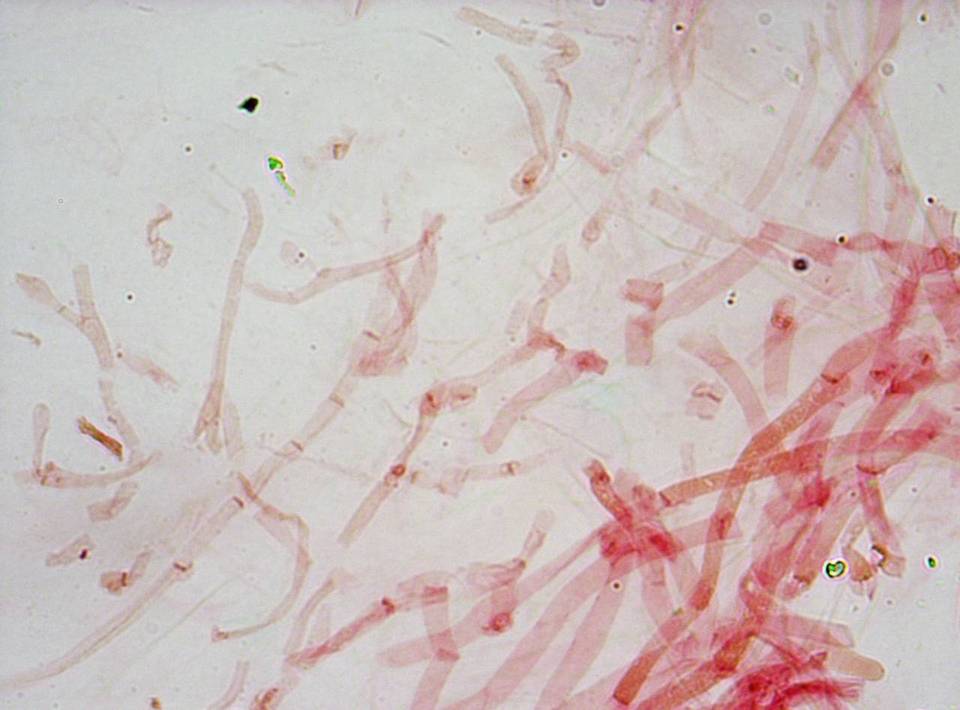 Meottomyces dissimulans image