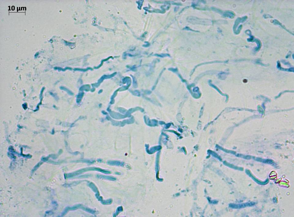 Meottomyces dissimulans image
