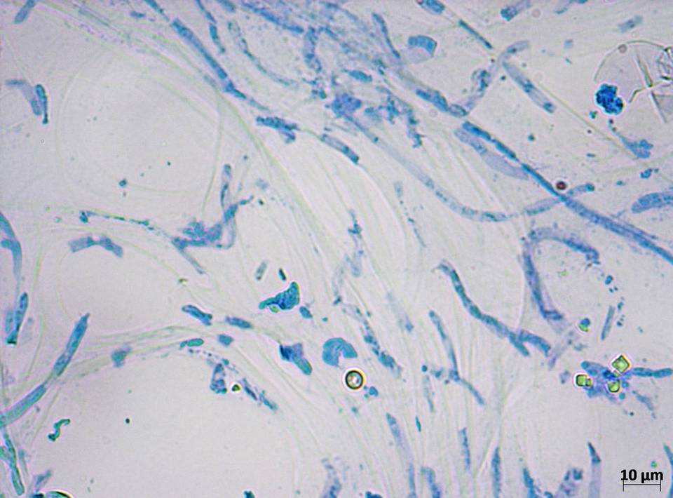Meottomyces dissimulans image
