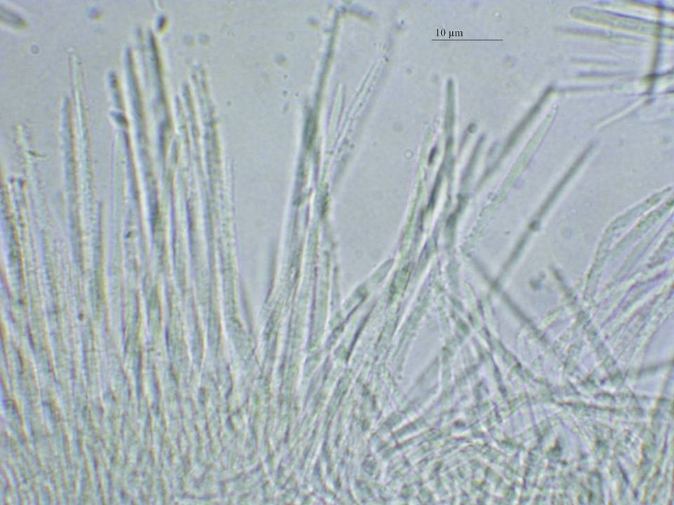 Dasyscyphella montana image