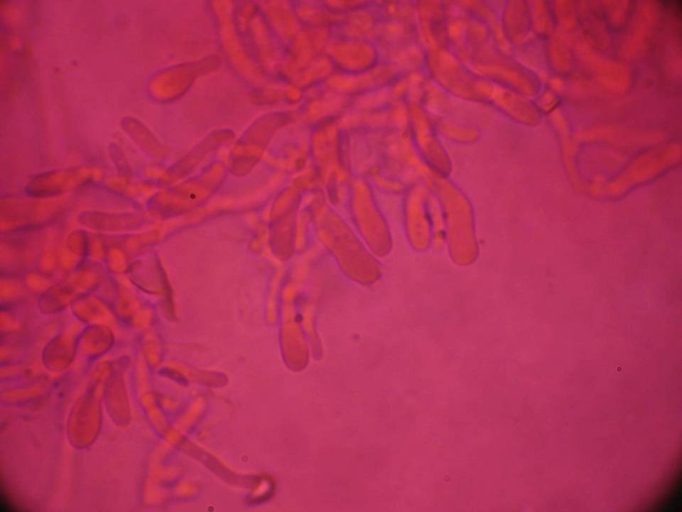 Cinereomyces lindbladii image