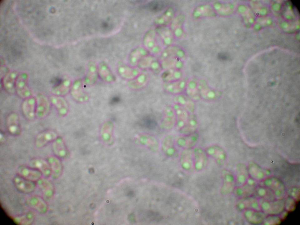 Sidera lenis image