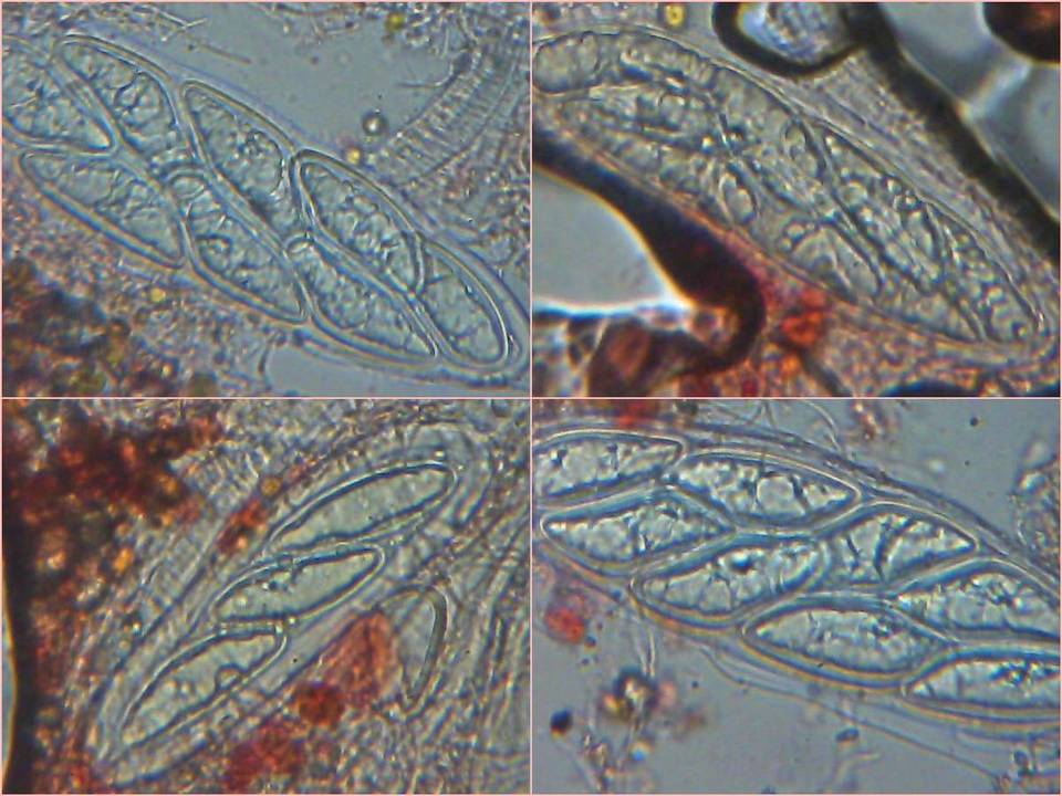 Pertusaria hymenea image