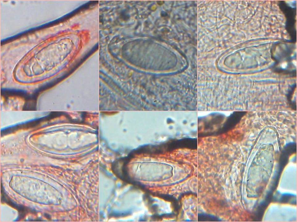 Pertusaria hymenea image