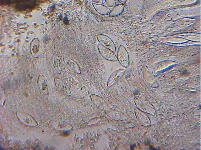 Pertusaria hymenea image
