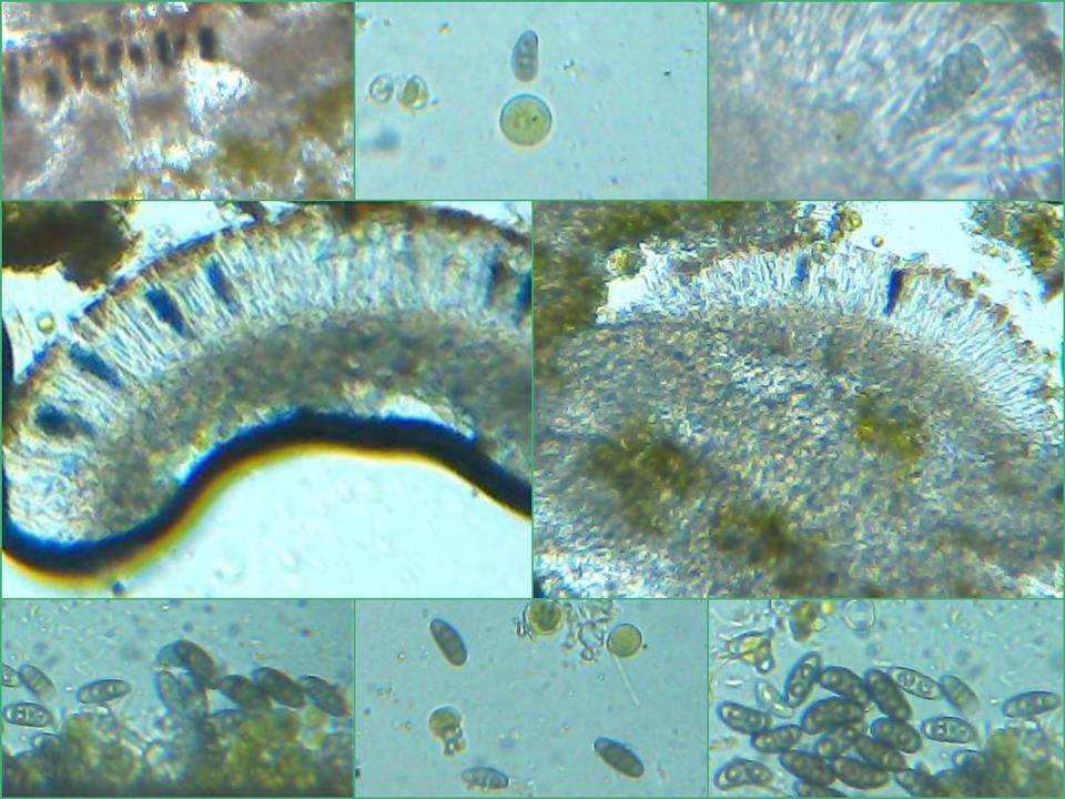 Physcia leptalea image