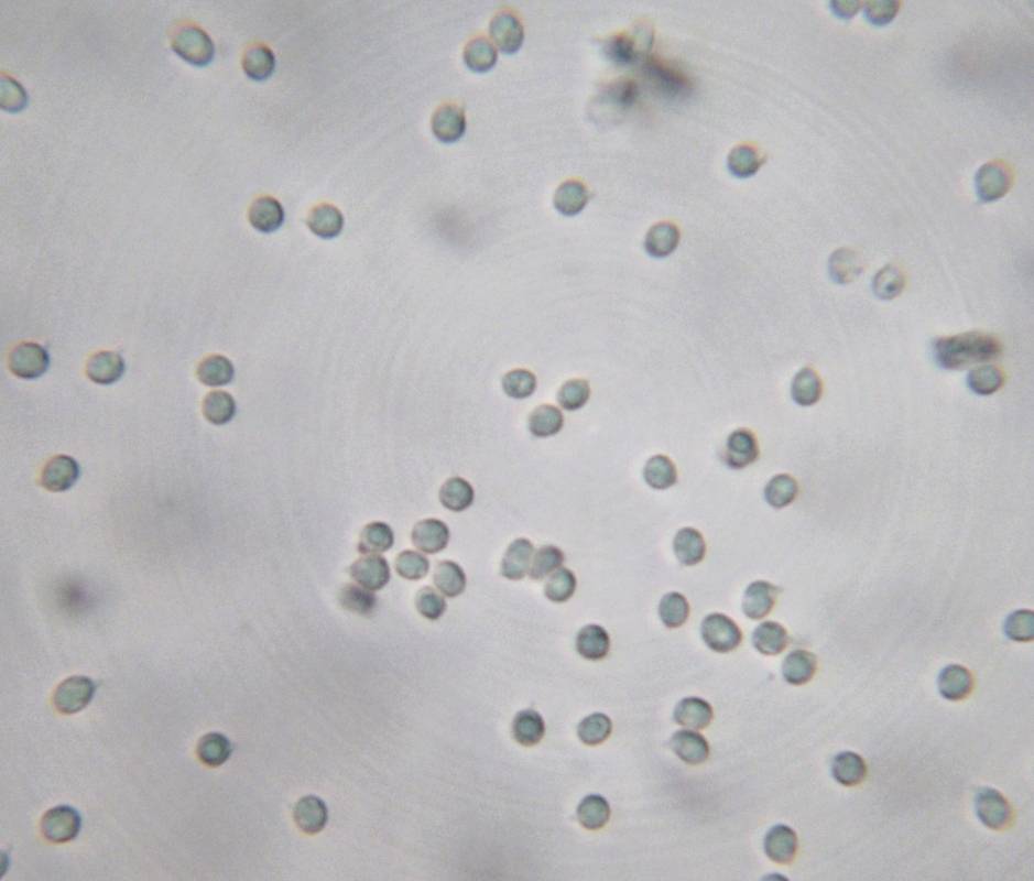 Limacella pitereka image