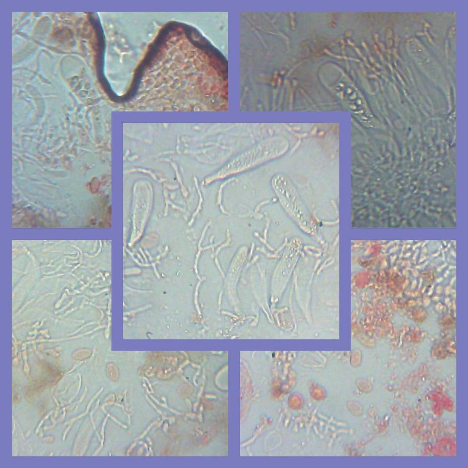 Lobothallia image