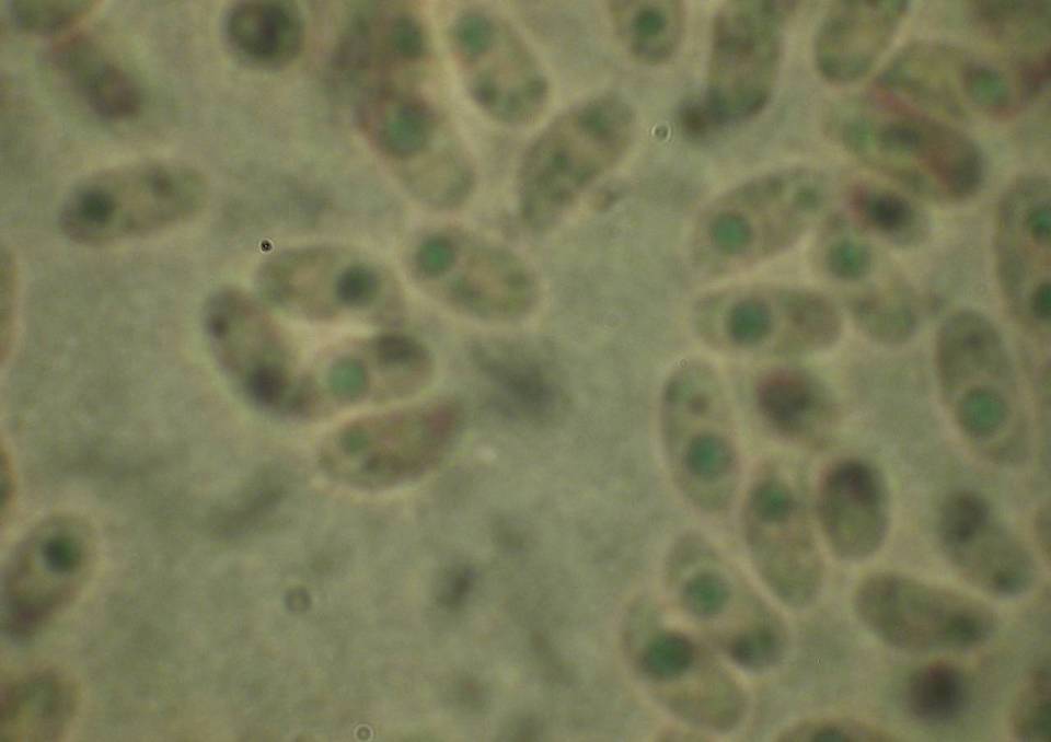 Basidioradulum crustosum image