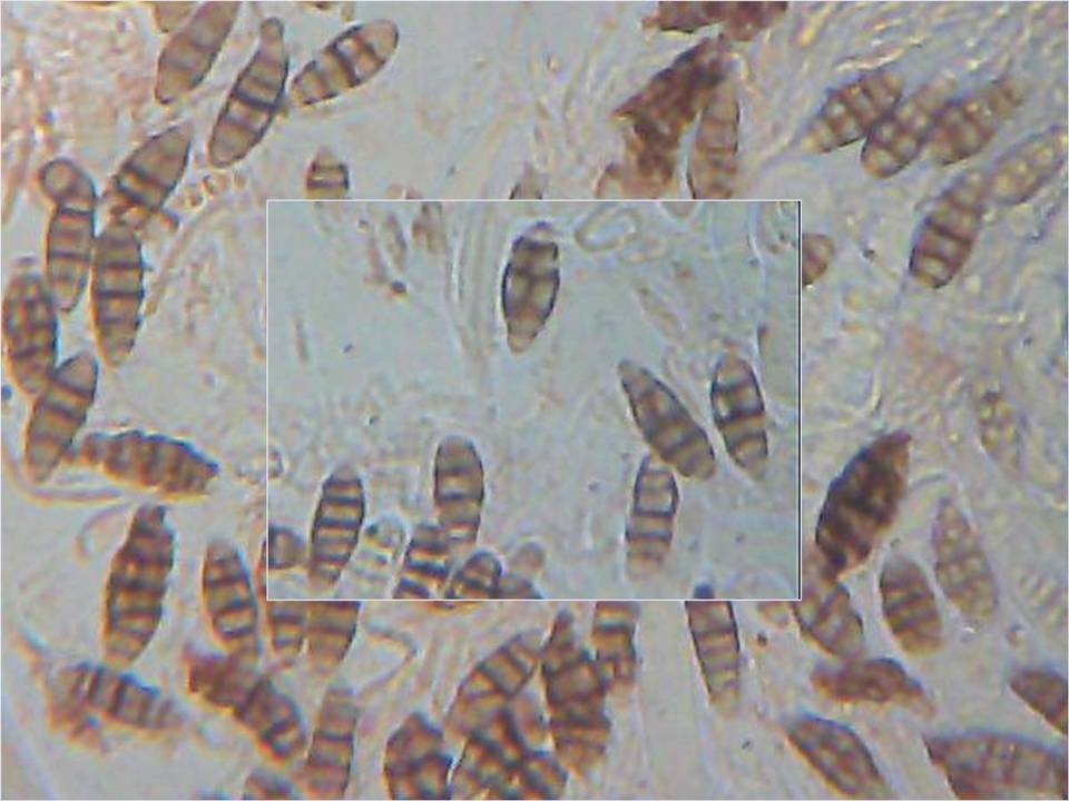 Diploschistes diacapsis image