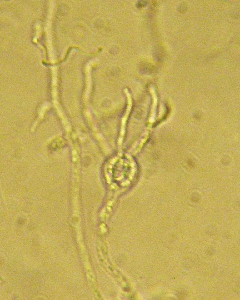 Tremella obscura image