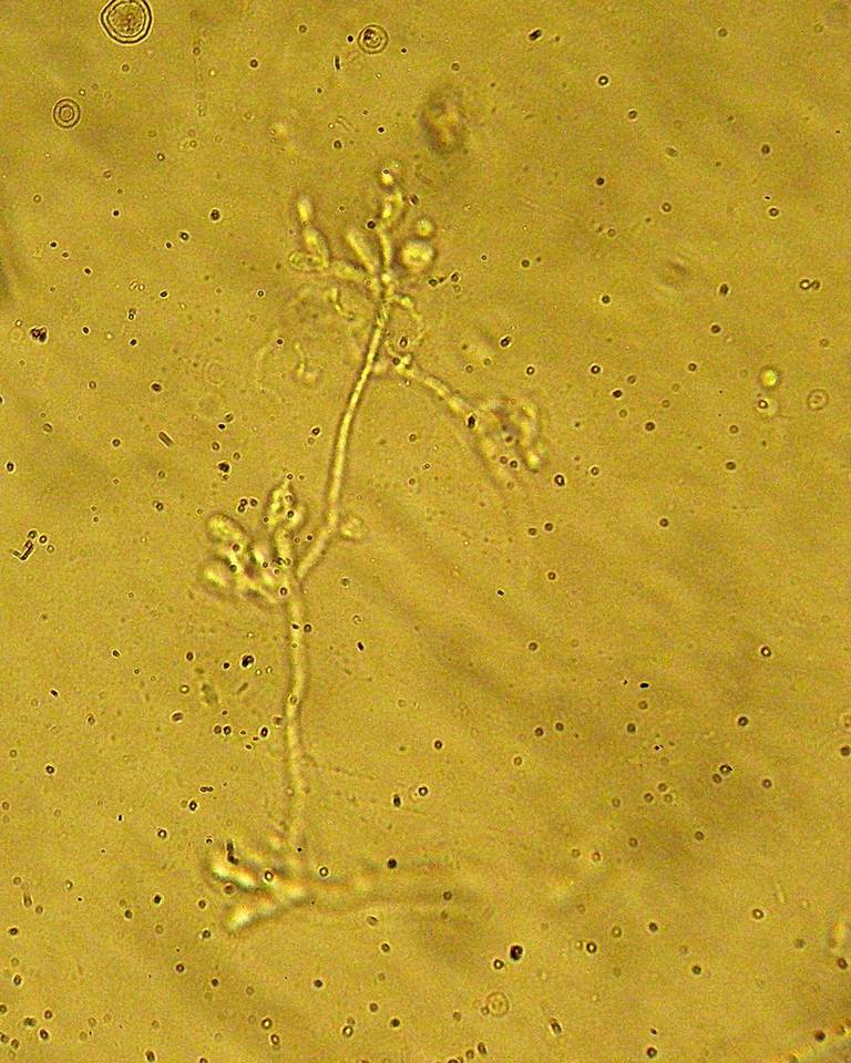 Tremella obscura image