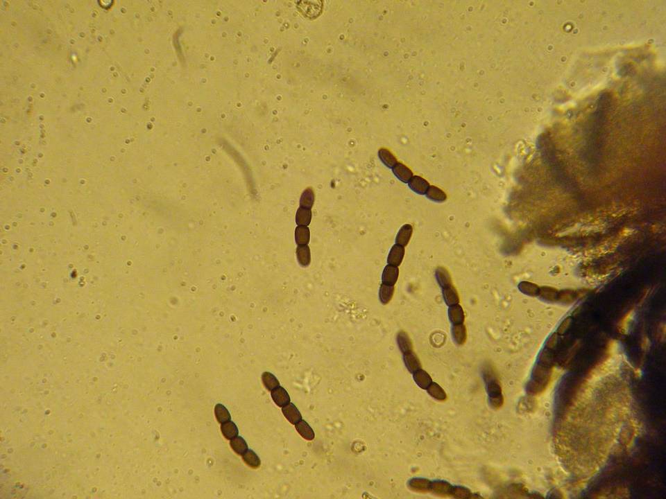 Sporormiella australis image