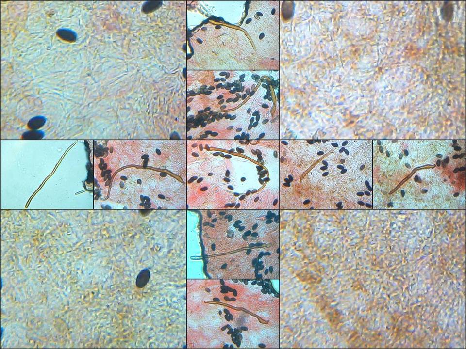 Parasola conopilea image