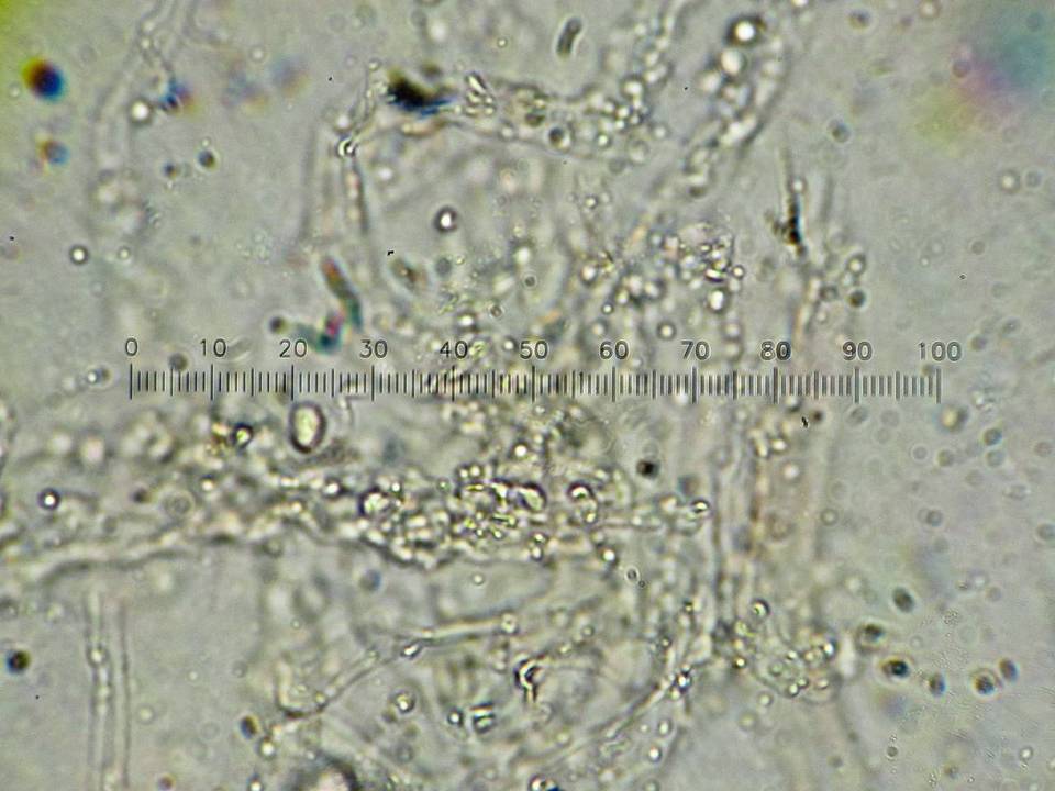Coprinopsis semitalis image