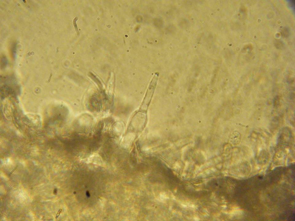 Melanoleuca humilis image
