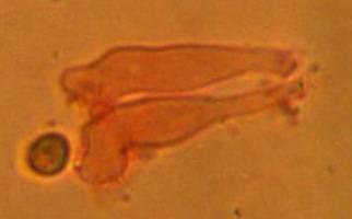 Atheniella leptophylla image