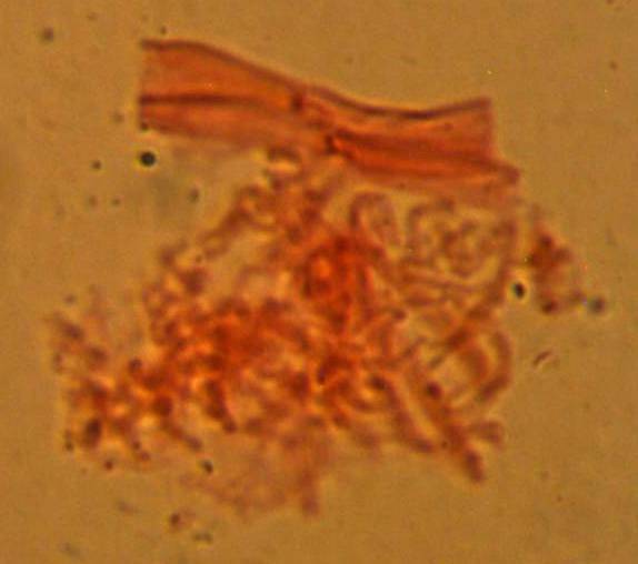 Atheniella leptophylla image