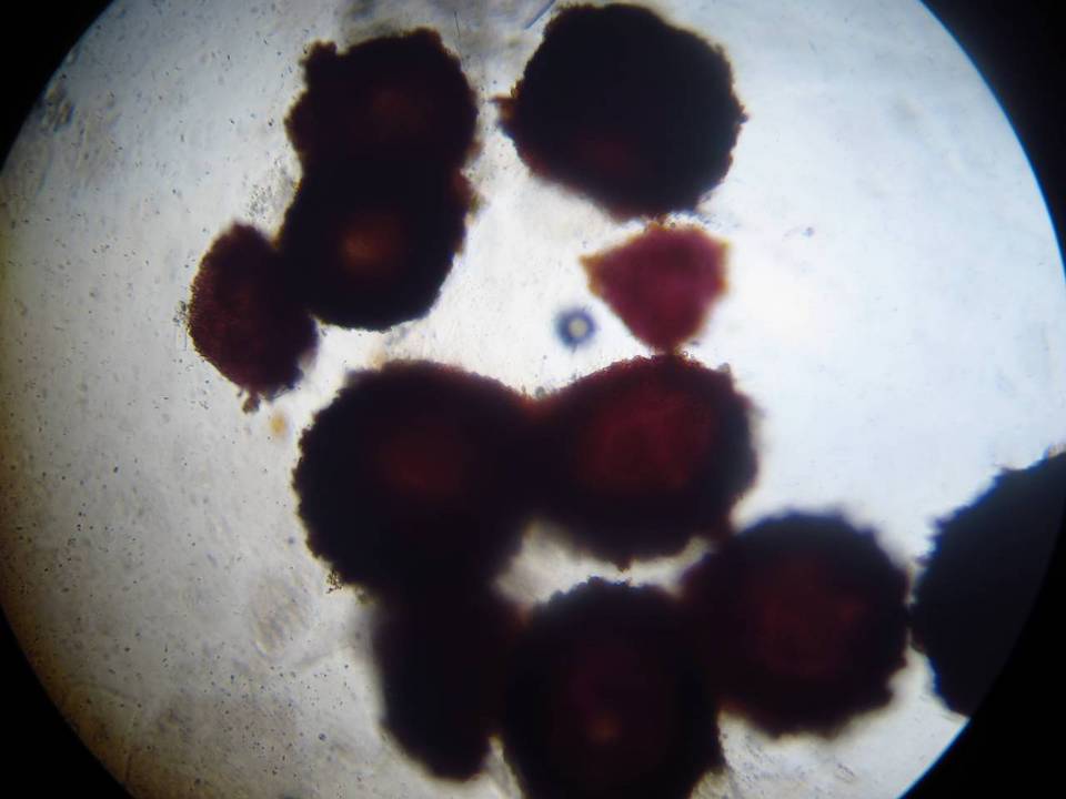 Nectria pseudotrichia image