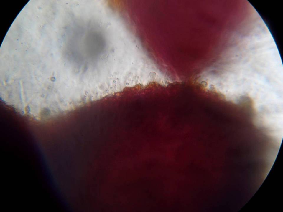 Nectria pseudotrichia image